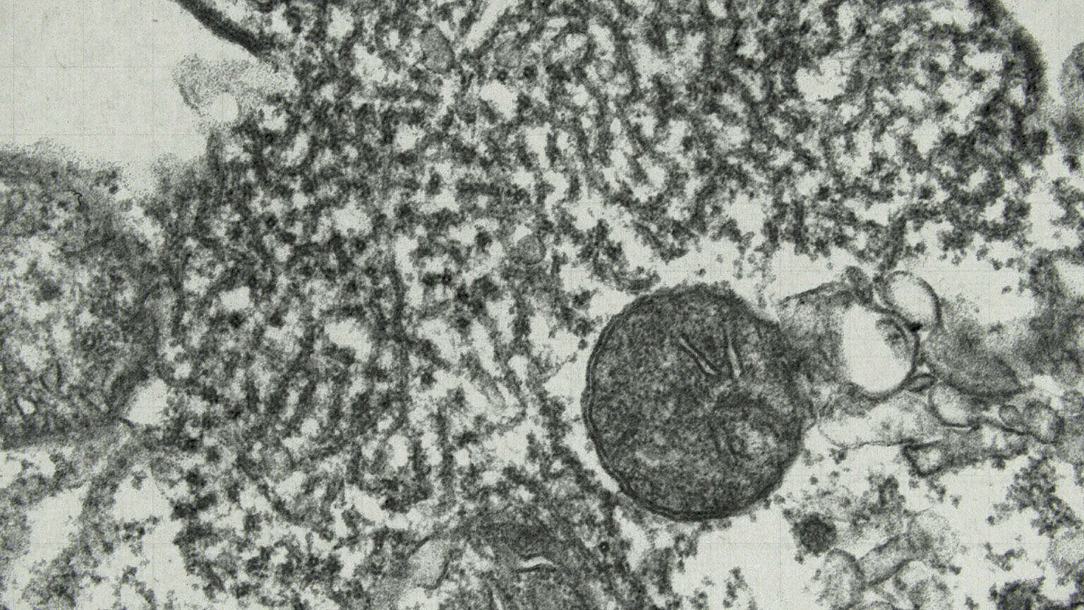 Photo 9 Spillover_Pressefoto_09_Nipah-Virus_MikroskopCDC